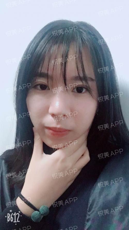 好久不'见'哦,最近中了抖音的毒去减网红刘海了
