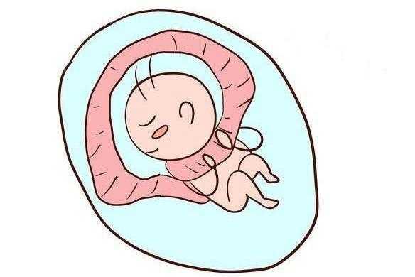 孕期不想胎儿出现脐带绕颈该怎么办
