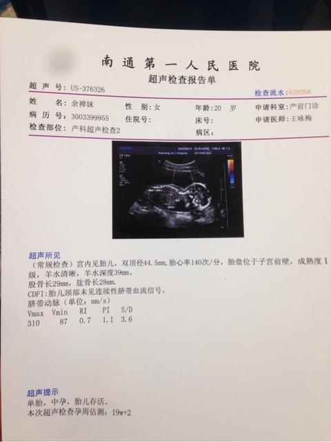 男人眉毛浓就能生男孩吗
