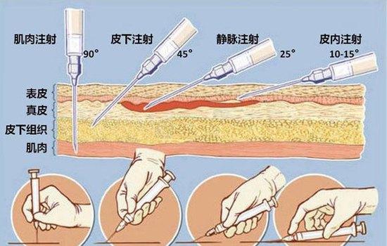 宝宝六个月可以打流感疫苗吗