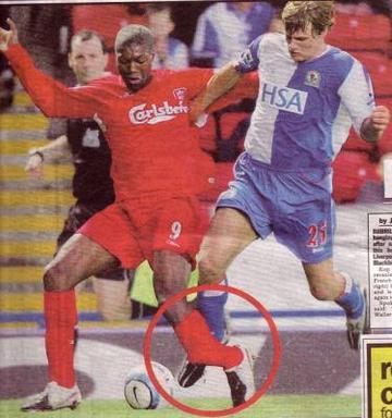 断腿后崛起的足球运动员的长尾关键词有哪些