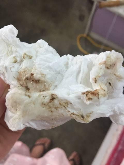 一岁宝宝吐奶怎么办