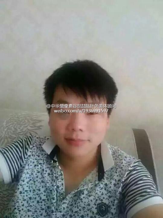 世喆贴针灸美体顾问的相册详情微女郎,微博美女创业,微博美女,