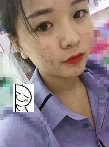 小姐姐化妆没美颜录抖音,直言说不需要男友,脸上的痘