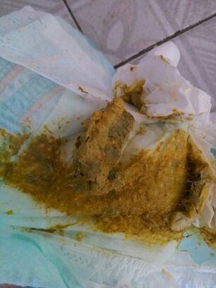 孩子拉奶瓣和奶粉有关系吗