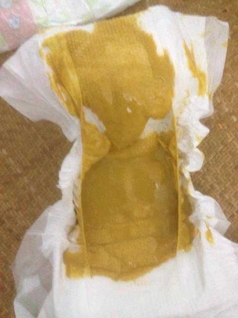 宝宝消化不良怎么办快速解决
