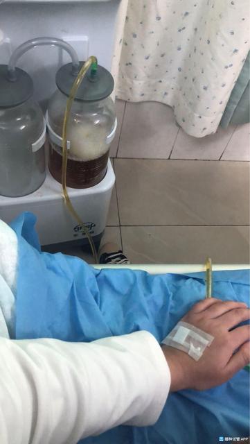 试管婴儿取卵后肚子胀怎么办