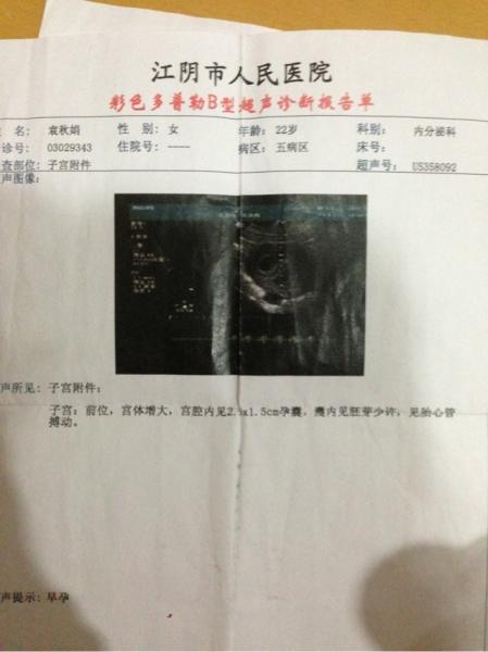 通过早期孕囊形状看性别准吗