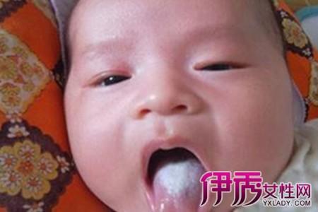 宝宝舌苔厚黄是怎么回事