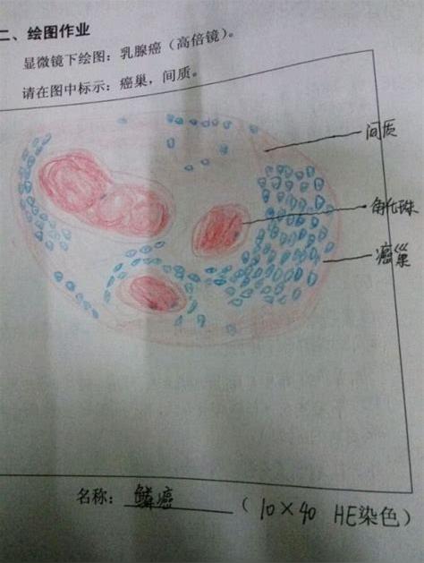 细胞间桥红蓝铅笔图