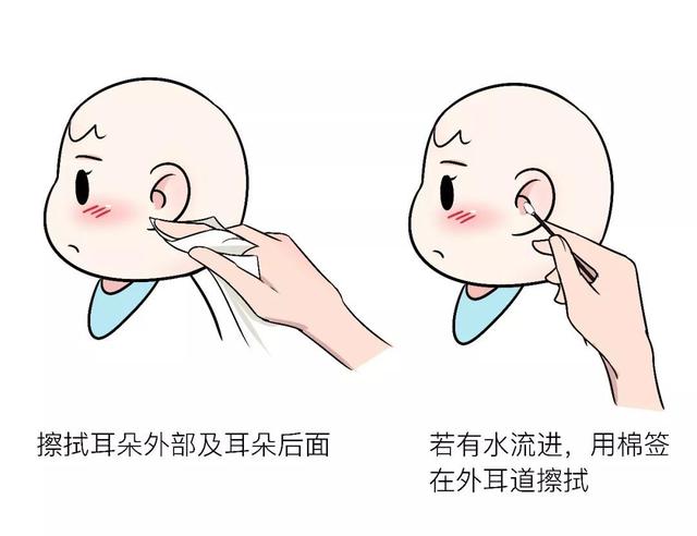 宝宝结膜炎怎么办