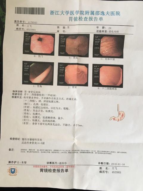 做胃镜到底有多痛苦