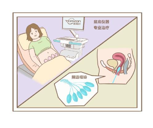 产后修复盆底肌需要用哑铃吗