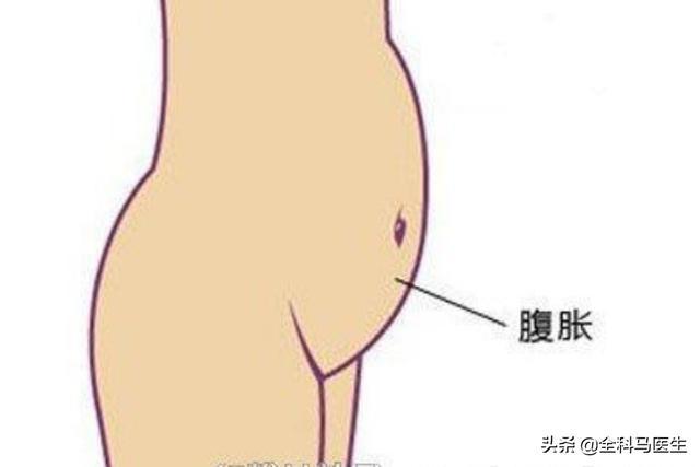 婴儿放屁5种异常情况