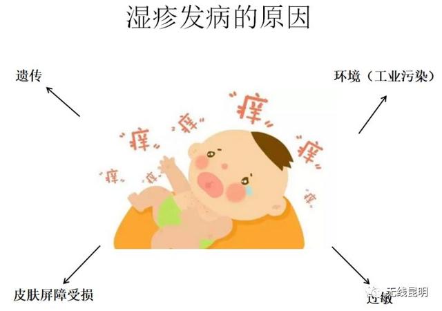 小孩湿疹会引起哮喘吗