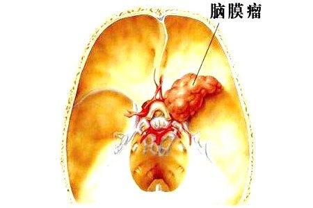 影响孩子视力的行为有哪些