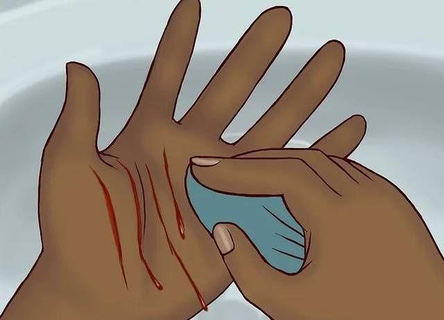 小孩子什么时候打狂犬疫苗