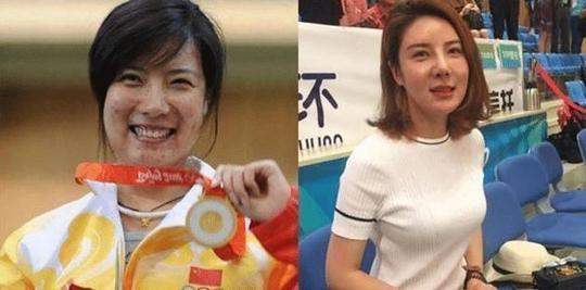 满脸痘痘|射击冠军杜丽，满脸痘痘早已消失，现嫁小4岁师弟，39岁韵味十足