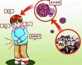 诺如病毒一般几天能好吃什么药