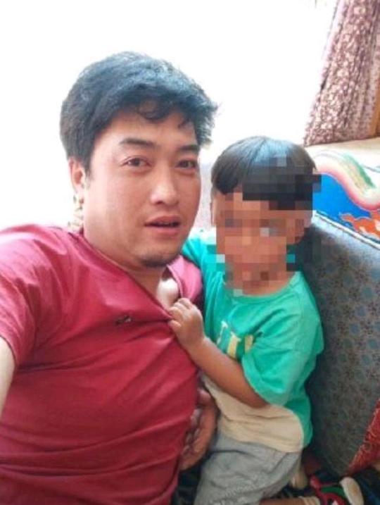 网红拉姆被前夫泼汽油，容颜尽毁成炭人，问题来了，救还是不救？