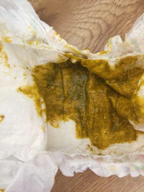 宝宝添加辅食后大便有变化吗