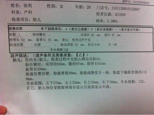 胎位不正会不会影响顺产