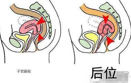 什么是子宫前位和子宫后位