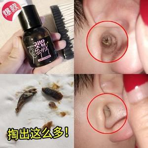 宝宝耳朵里有硬耳屎怎么办