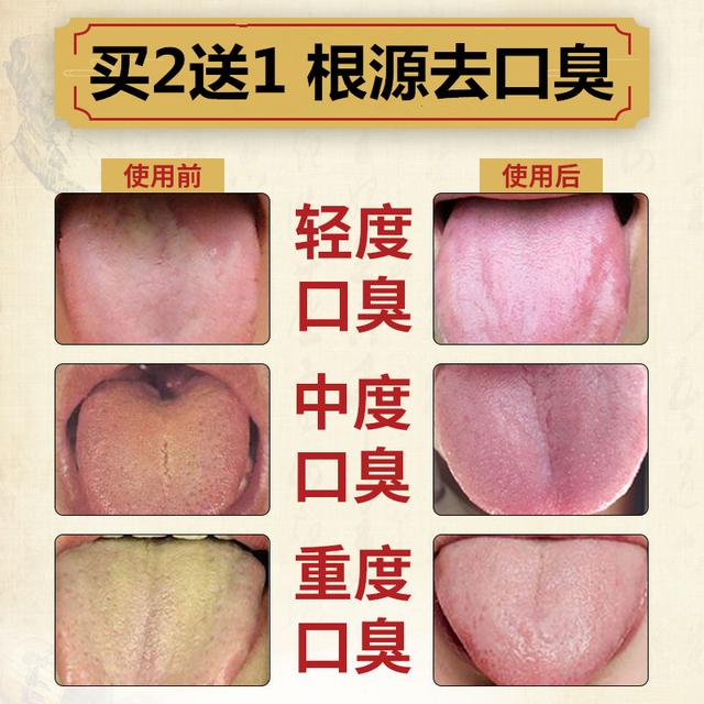2岁宝宝肝火旺盛怎么调理