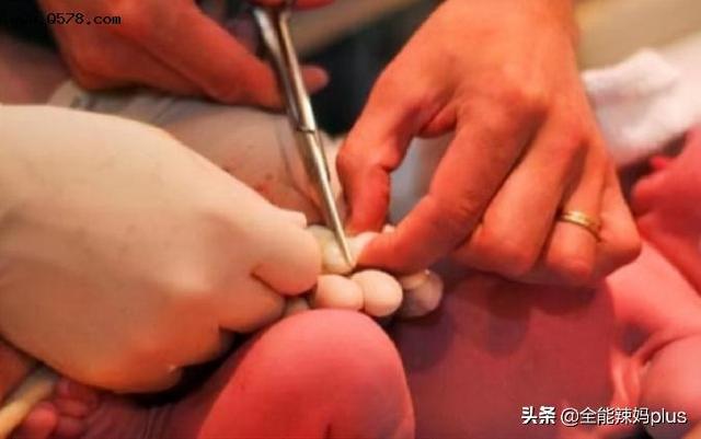 剪脐带的时候宝宝会疼吗