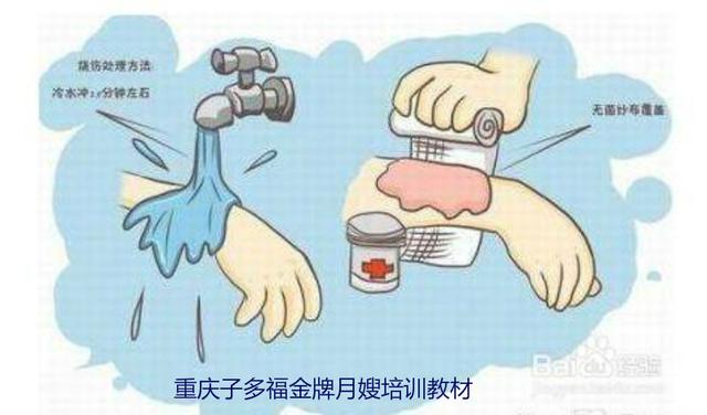 孩子被烫伤急救方法