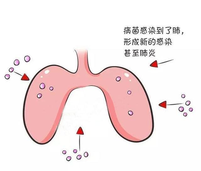 一岁半宝宝咳嗽怎么办
