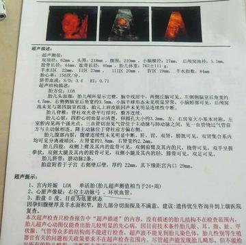 18周产检要做什么检查的长尾关键词有哪些