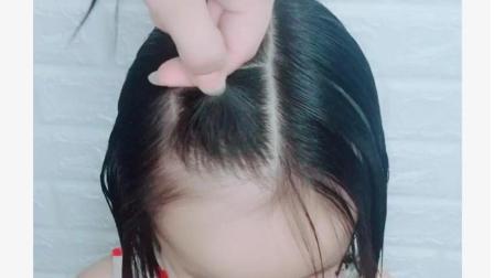 胎儿的头发多少和什么有关