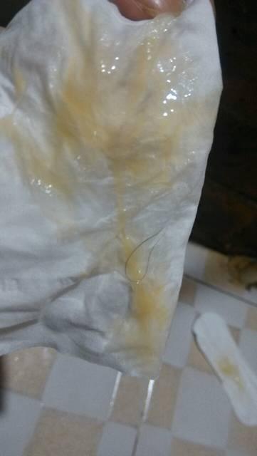 顺产后恶露多久干净算正常