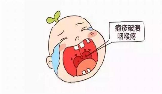 手足口病得过一次还会再得吗