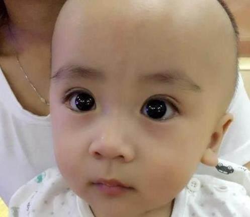 双眼皮父母会生出单眼皮孩子吗?