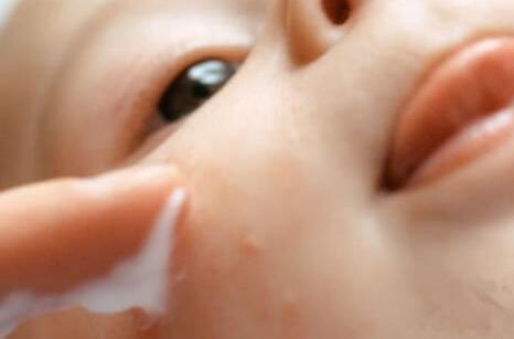 秋季宝宝皮肤护理的法则