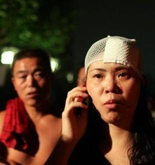 梦见自己乳房流血了