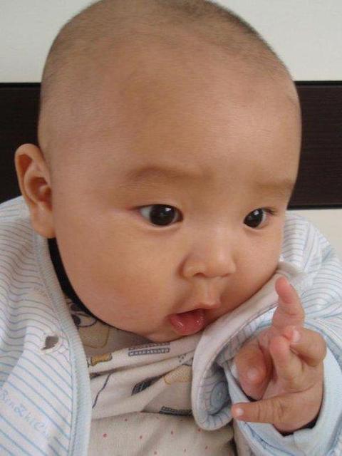 发现宝宝有斗鸡眼怎么办