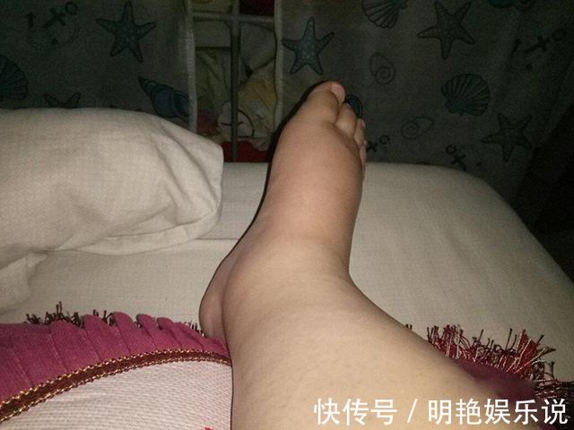 孕期手脚发麻是怎么回事