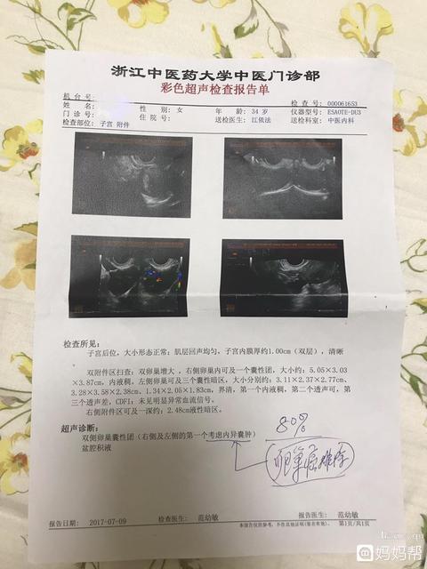 腺肌症和巧克力囊肿能治愈吗