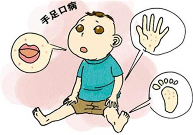 手足口病高发期打疫苗来得及吗