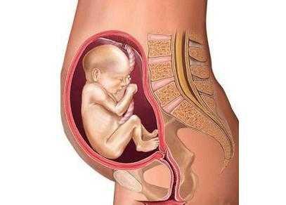 孕期怎么做可以避免胎位不正