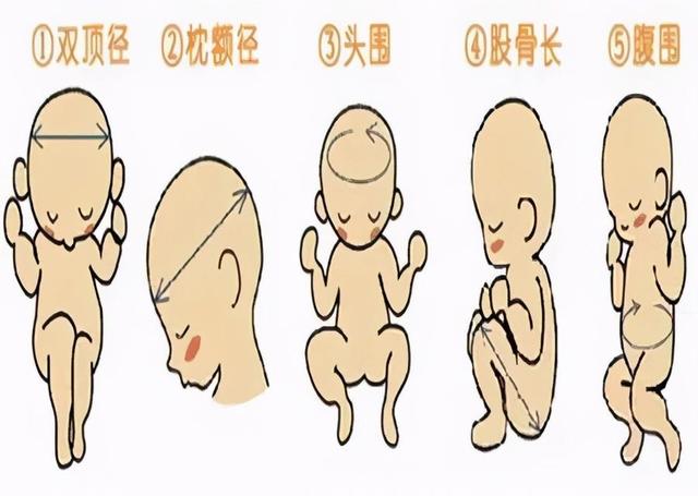 妊娠期糖尿病筛查一定要做吗