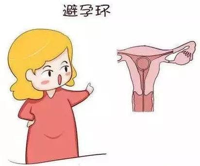 取环后立即怀孕好吗？建议最好不要