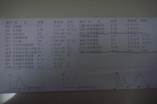 孕妇总胆红素偏高对胎儿有影响吗