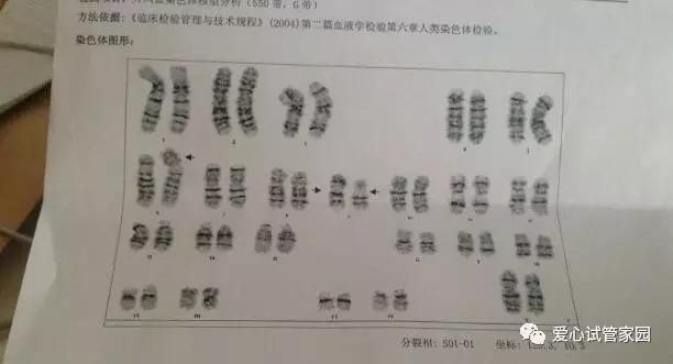关于性染色体异常的小知识