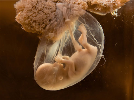 孕妇羊水少对胎儿有什么影响