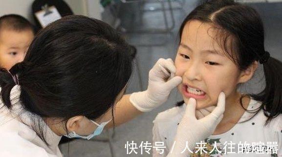 宝宝换牙过早好吗